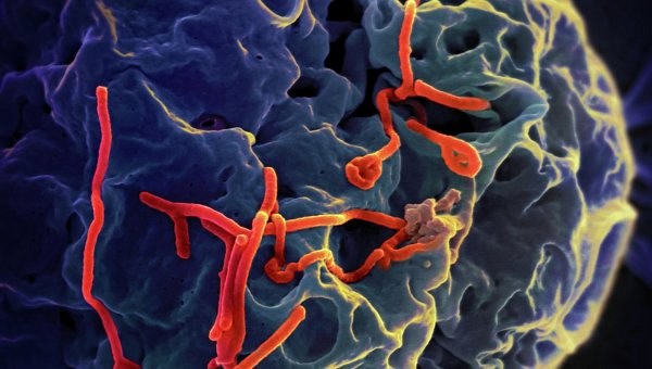 Вирусологи нашли "ахиллесову пяту" у вируса лихорадки Эбола